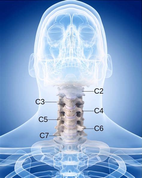 Acdf Anterior Cervical Discectomy And Fusion Uoa Spinal Orthopedics