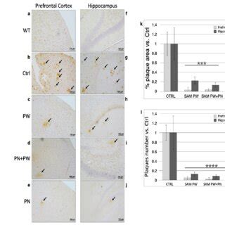 Amyloid Plaque Burden In Tgcrnd Mouse Brains At Months Of Age From