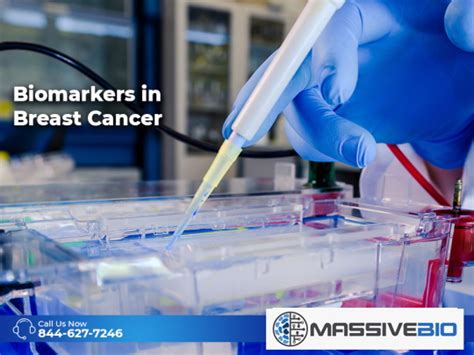 Biomarkers In Breast Cancer Clinical Use Of Biomarkers Massive Bio