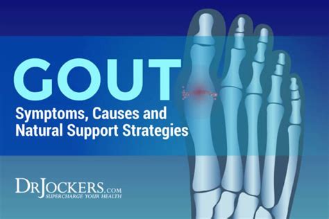 Gout symptoms causes and natural support strategies – Artofit