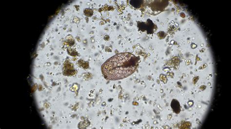 Biological Assessment With Microscope Catalyst BioAmendments