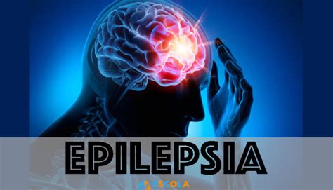 Epilepsia O Que é Causas Sintomas Tratamento Tipos Cura