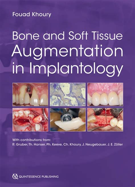 Fouad Khoury Editor Bone And Soft Tissue Augmentation In