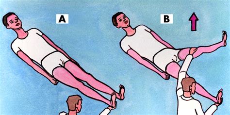 Hoover's sign - by Gavin Giovannoni - Teach Neurology