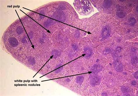 Spleen histology Flashcards | Quizlet