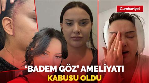 Badem G Z Ameliyat Hayat N Karartt Gen Kad N N Kabusu Oldu Youtube