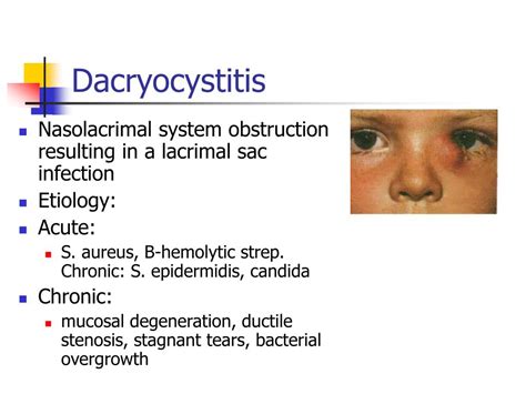 Ppt The Differential Diagnosis Of The Red Eye Powerpoint Presentation