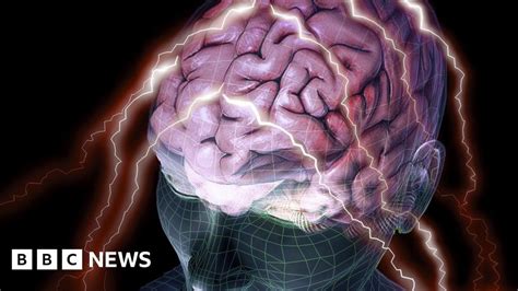 Personality Linked To Differences In Brain Structure Bbc News