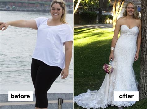 15 Fascinating Weight Loss Surgery before and after Success Story ...