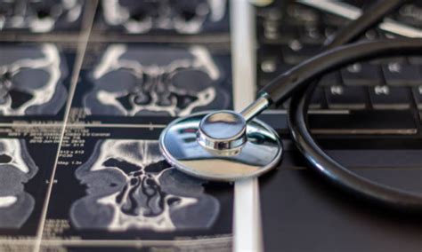 What Is a Sinus CT Scan? Key Facts and Benefits