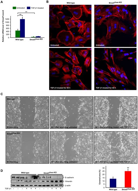 Deletion Of Smad7 Enhances Tgf β Induced Emt A Confirmation Of Smad7