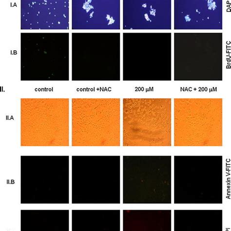 Effect Of DETC On Cell Viability Using TB Exclusion Assay And MTT Test