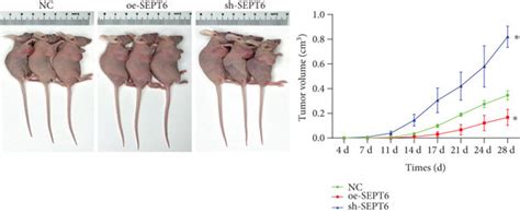 SEPT6 Inhibited Tumor Growth In Nude Mice A The Tumor Volume Of Each