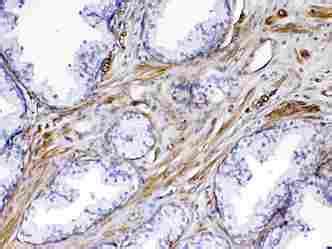 Flt Vegfr Antibody Ls C Unconjugated Rabbit Polyclonal