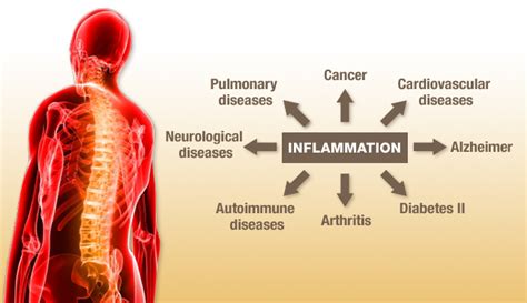 Joint Inflammation Relief