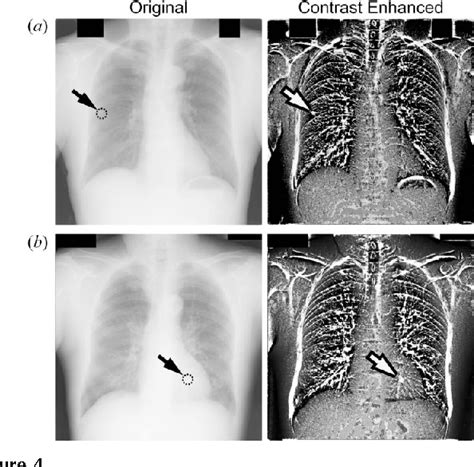 Figure From Morphological Image Processing For Quantitative Shape