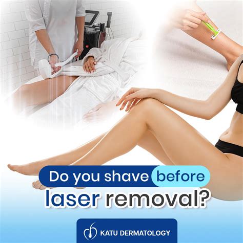 Do You Shave Before Laser Removal Katu Dermatology Clinic