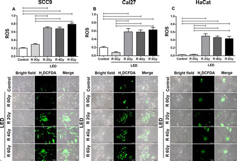 Detection Of Intracellular ROS In SCC9 Cal 27 And HaCat Cells Treated