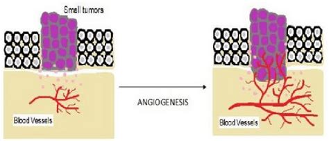 Process of angiogenesis in cancer. | Download Scientific Diagram