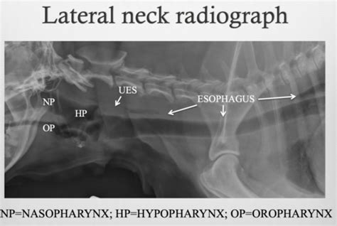 Lecture 11: Fluoroscopy / Radiographs Upper GI Flashcards | Quizlet