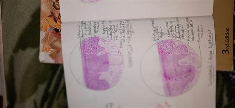 SOLUTION: LEUKOPLAKIA histology diagram - Studypool