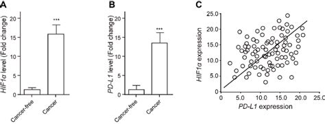 Increased Expressions Of Hif1α And Pd L1 In Ftc Tissue The Expression