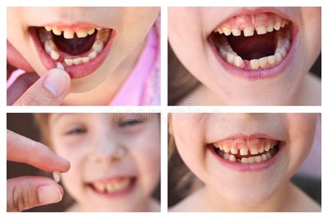 Enfant De Fille Avec Le Mal De Dents Photo Stock Image Du Lait