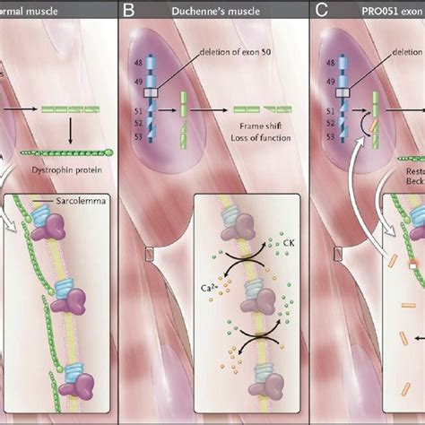 Mechanism of action of AO exon-skipping drugs. A: Dystrophin gene... | Download Scientific Diagram