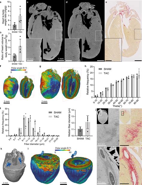 3D Histopathology Of Pressure Overload Induced Hypertrophic Murine