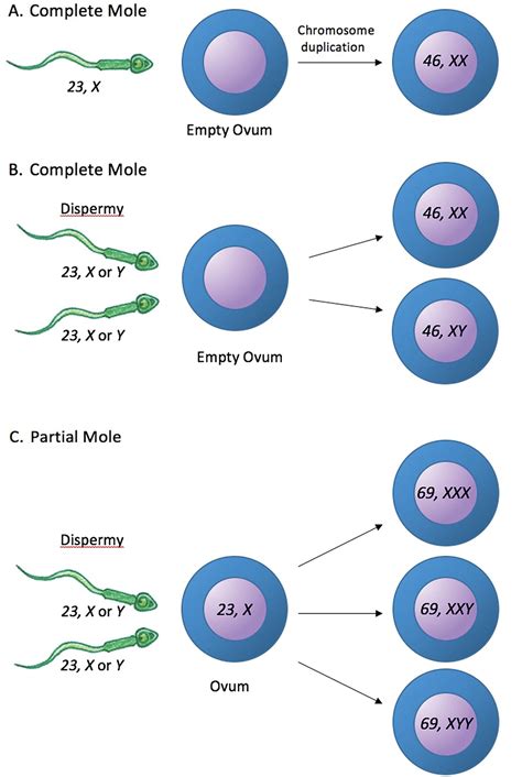 What is a Molar Pregnancy?