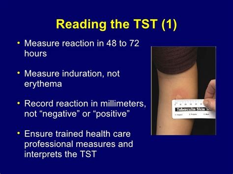 Latent Tuberculosis: Identification and Treatment