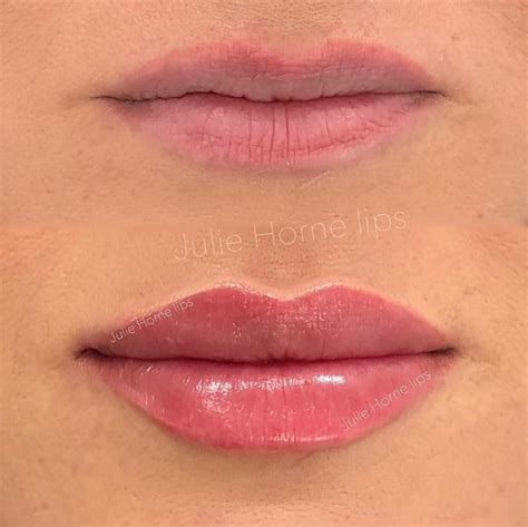 Penjelasan Lengkap Ml Natural Lip Fillers Ideas