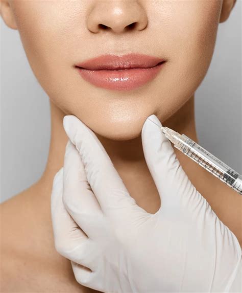 Chin Filler 1ml Clinic Simone