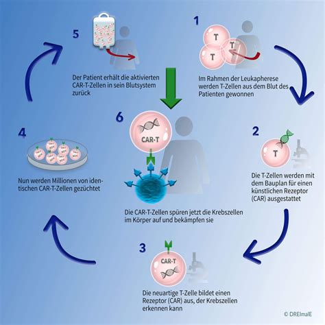 Universit Tsklinikum Heidelberg Car T Zelltherapie