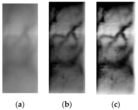 Sensors Free Full Text A Degraded Finger Vein Image Recovery And