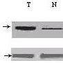 Vasp Expression By Western Blot Immunostaining Of Vasp Expression