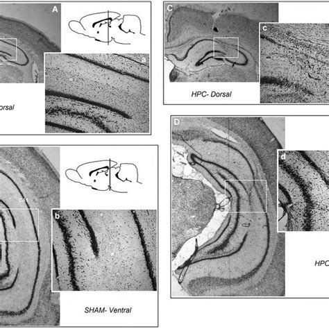 Schematic Illustration Of Dorsal And Ventral Hippocampus Lesions