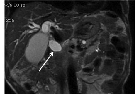 Applying The Single Shot Fast Spin Echo Imaging Technique A T2 Download Scientific Diagram