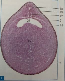 Lab 1 - Neural Tube Stage - I Diagram | Quizlet