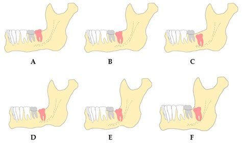 Inferior Alveolar Nerve Distribution