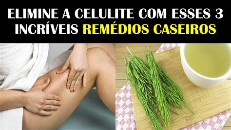 CELULITE SAIBA COMO ACABAR ESSES 3 EXTRAORDINARIOS REMEDIOS