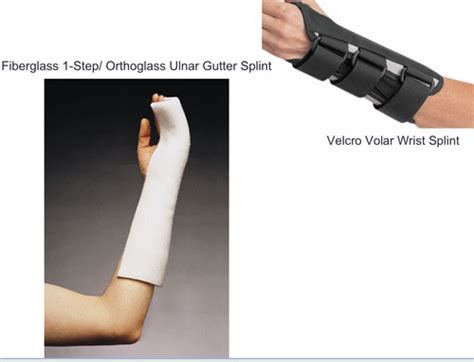 Splinting And Casting Flashcards Quizlet