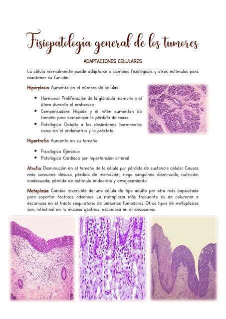 Neoplasias Jose Riofrio UDocz