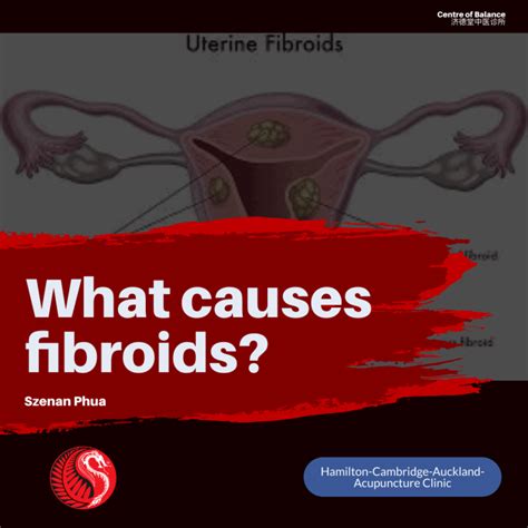 List 105 Pictures Pictures Of Fibroids With Hair And Teeth Superb