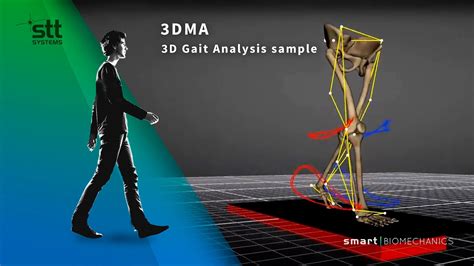 3d Gait Analysis Sample 3dma Youtube