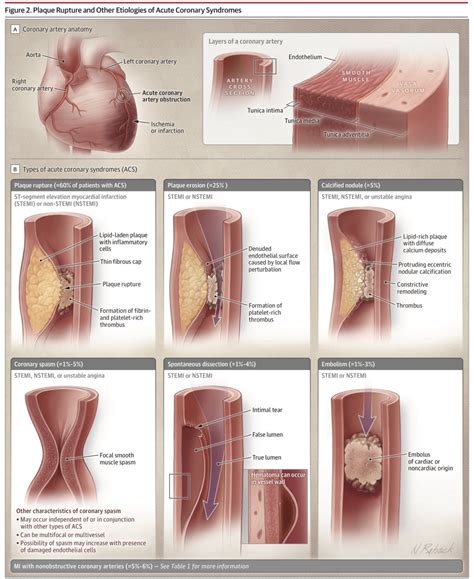 The Innovation Medicine On Twitter Pathophysiology Of Acute