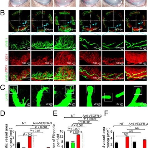 Anti Vegfr Blocks Fgf Induced Lymphangiogenesis And Lymphatic Tip