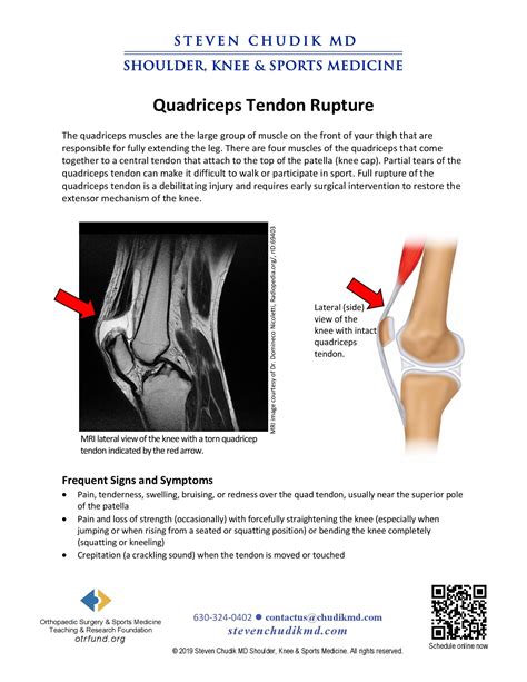 Quadriceps Tendon Rupture - Steven Chudik MD