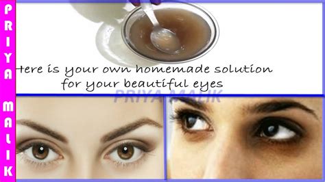 How To Remove Dark Circles Naturally At Home In 7 Days How To Get Rid