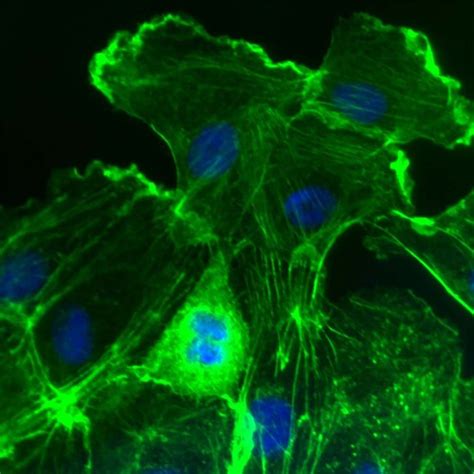 Fibroblast cells activate, divide and play key roles in both tissue ...